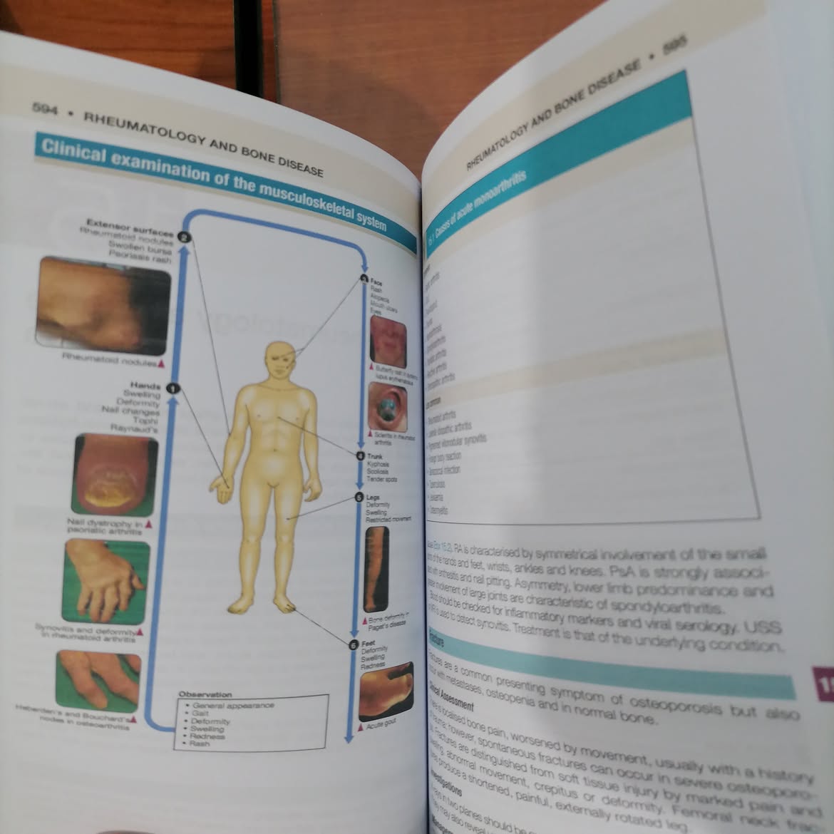 Davidson's Principles and Practice of Medicine 24e (3 Volume -Color Book)